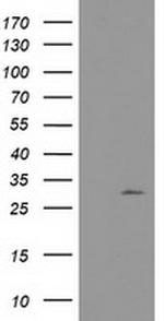 NUBPL Antibody in Western Blot (WB)