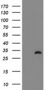 NUBPL Antibody in Western Blot (WB)