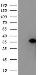NUBPL Antibody in Western Blot (WB)
