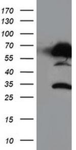 NUCB1 Antibody in Western Blot (WB)
