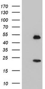 NUCB1 Antibody in Western Blot (WB)