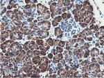 NUDT18 Antibody in Immunohistochemistry (Paraffin) (IHC (P))