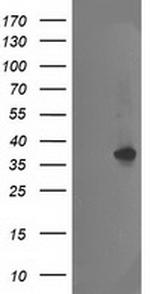 NUDT18 Antibody in Western Blot (WB)