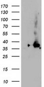 NUDT18 Antibody in Western Blot (WB)