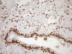 NUDT21 Antibody in Immunohistochemistry (Paraffin) (IHC (P))