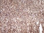 NUDT21 Antibody in Immunohistochemistry (Paraffin) (IHC (P))