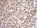 NUDT21 Antibody in Immunohistochemistry (Paraffin) (IHC (P))