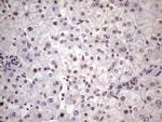 NUDT21 Antibody in Immunohistochemistry (Paraffin) (IHC (P))