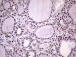 NUDT21 Antibody in Immunohistochemistry (Paraffin) (IHC (P))