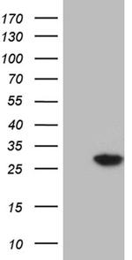 NUDT4 Antibody in Western Blot (WB)