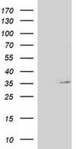 NUDT6 Antibody in Western Blot (WB)