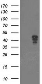 NUDT9 Antibody in Western Blot (WB)
