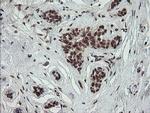 NUMB Antibody in Immunohistochemistry (Paraffin) (IHC (P))