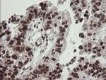 NUMB Antibody in Immunohistochemistry (Paraffin) (IHC (P))