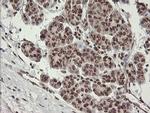 NUMB Antibody in Immunohistochemistry (Paraffin) (IHC (P))