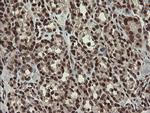 NUMB Antibody in Immunohistochemistry (Paraffin) (IHC (P))