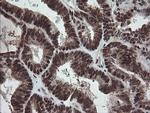 NUMB Antibody in Immunohistochemistry (Paraffin) (IHC (P))
