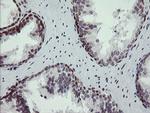 NUMB Antibody in Immunohistochemistry (Paraffin) (IHC (P))