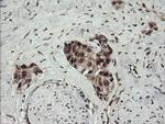 NUMB Antibody in Immunohistochemistry (Paraffin) (IHC (P))