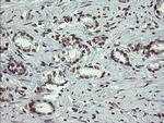 NUMB Antibody in Immunohistochemistry (Paraffin) (IHC (P))