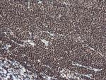 NUMB Antibody in Immunohistochemistry (Paraffin) (IHC (P))
