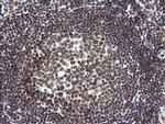 NUMB Antibody in Immunohistochemistry (Paraffin) (IHC (P))