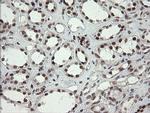 NUMB Antibody in Immunohistochemistry (Paraffin) (IHC (P))