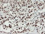 NUMB Antibody in Immunohistochemistry (Paraffin) (IHC (P))