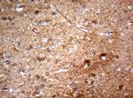 NUMB Antibody in Immunohistochemistry (Paraffin) (IHC (P))
