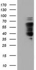 NUMB Antibody in Western Blot (WB)