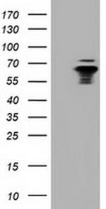 NUMB Antibody in Western Blot (WB)