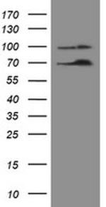 NUMB Antibody in Western Blot (WB)