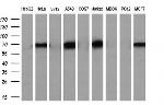 NUMB Antibody in Western Blot (WB)