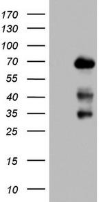 NUMB Antibody in Western Blot (WB)