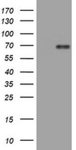 NUMB Antibody in Western Blot (WB)