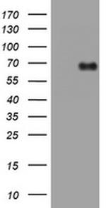 NUMB Antibody in Western Blot (WB)