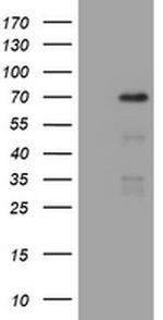NUMB Antibody in Western Blot (WB)