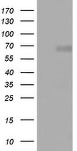NUMB Antibody in Western Blot (WB)