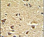 NUP155 Antibody in Immunohistochemistry (IHC)