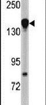 NUP155 Antibody in Western Blot (WB)