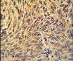 gp210 Antibody in Immunohistochemistry (IHC)