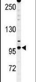 gp210 Antibody in Western Blot (WB)