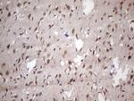 NUP43 Antibody in Immunohistochemistry (Paraffin) (IHC (P))