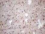 NUP43 Antibody in Immunohistochemistry (Paraffin) (IHC (P))