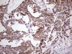 NUP43 Antibody in Immunohistochemistry (Paraffin) (IHC (P))