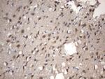 NUP43 Antibody in Immunohistochemistry (Paraffin) (IHC (P))