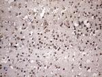 NUP43 Antibody in Immunohistochemistry (Paraffin) (IHC (P))