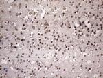 NUP43 Antibody in Immunohistochemistry (Paraffin) (IHC (P))