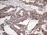 NUP43 Antibody in Immunohistochemistry (Paraffin) (IHC (P))