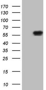 NUP43 Antibody in Western Blot (WB)